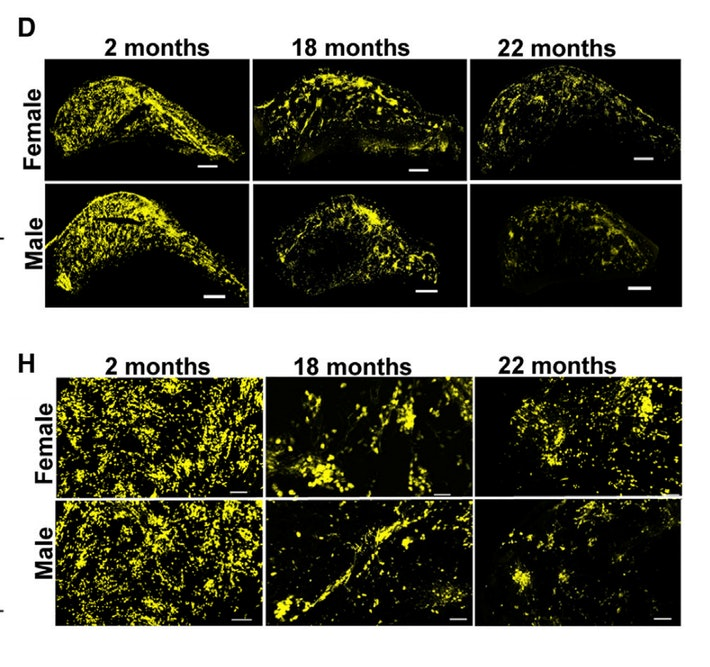 Click to enlarge neurons