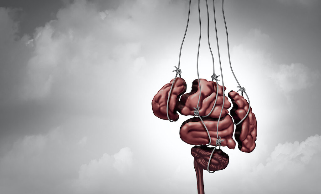 brain barbwire
