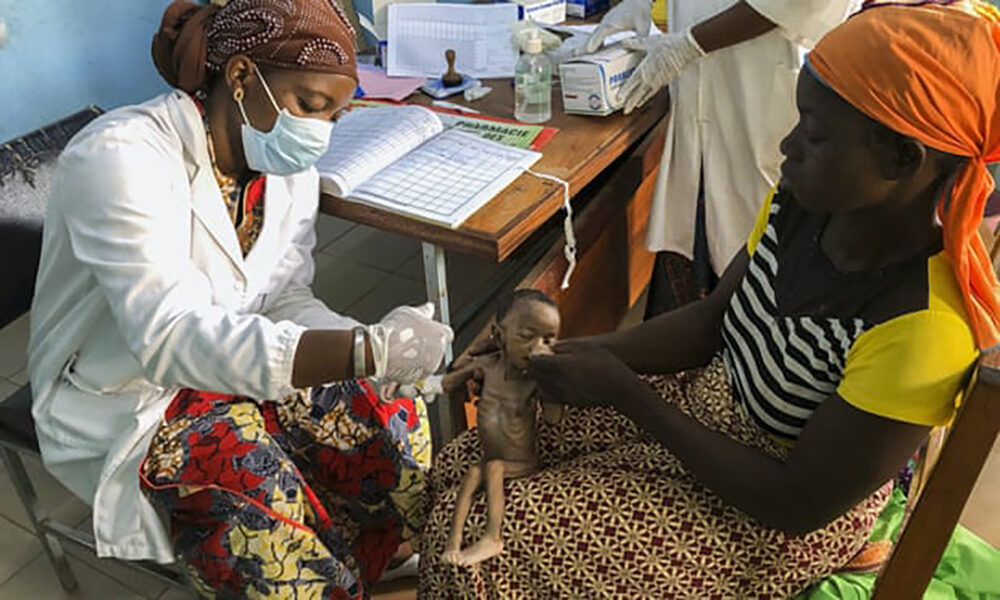 Click to enlarge Starved baby