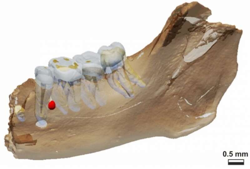 jawbone