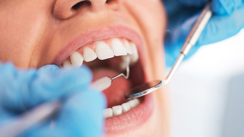 Dentist Visit