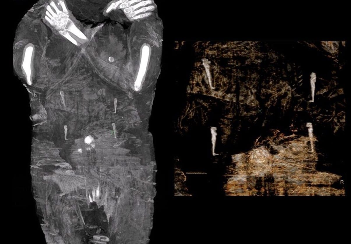 Click to enlarge Pregnant Mummy