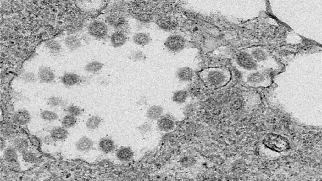 Click to enlarge coronavirus covid electron miscroscope