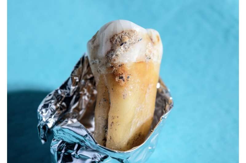Click to enlarge tooth