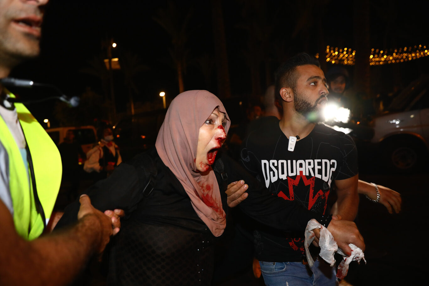 Palestinians help a woman injured by Israeli police