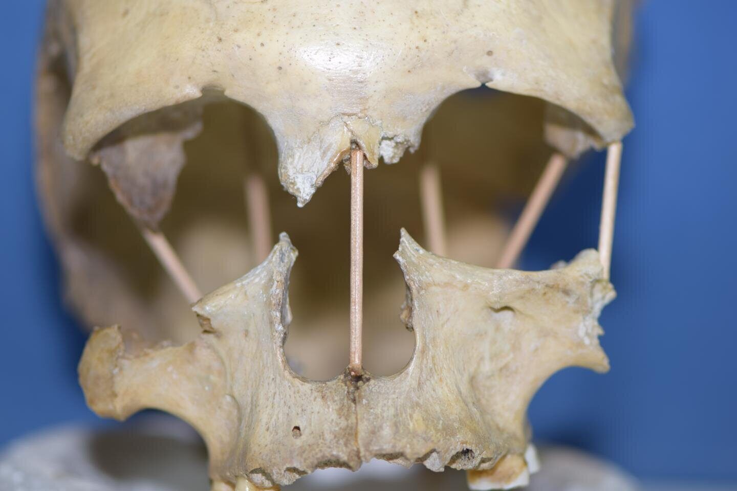 skull of Peştera Muierii 1