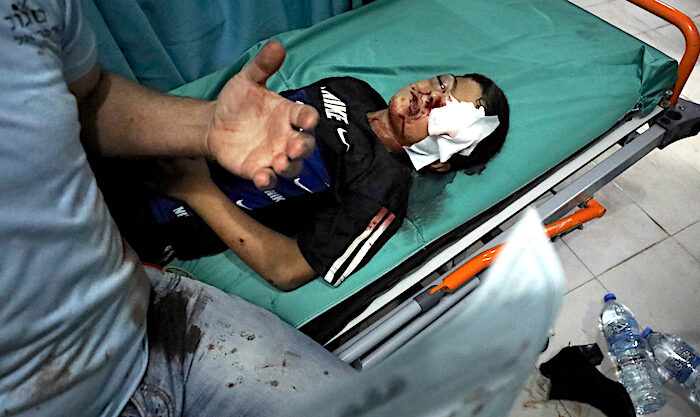 Wounded boy