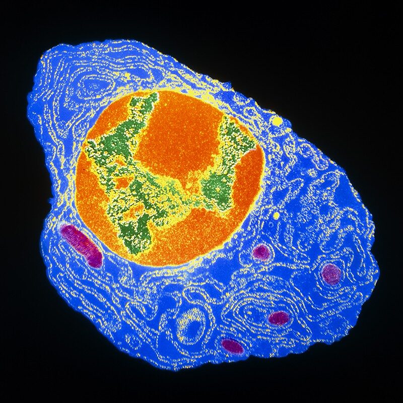bone marrow plasma cell antibodies covid