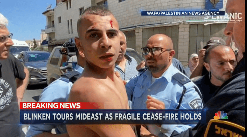 Click to enlarge Palestinian boy beaten by Israeli police
