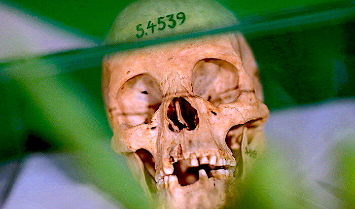Click to enlarge human skull