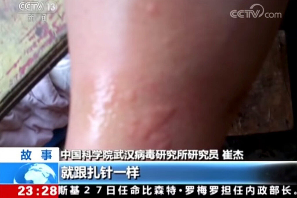 Click to enlarge bat bite wuhan lab