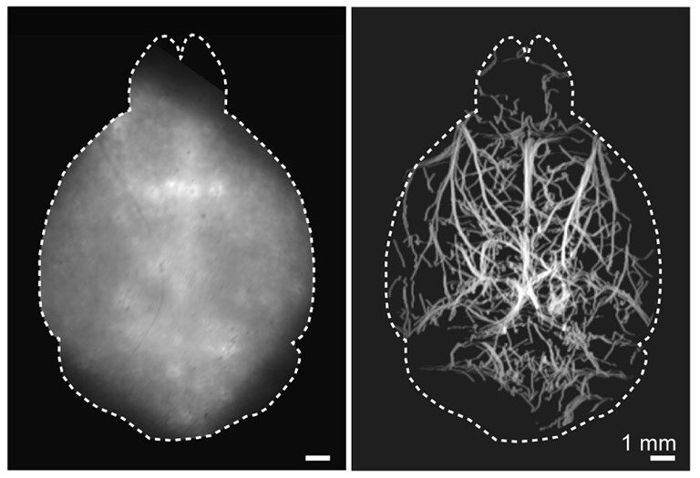 Click to enlarge new imaging method