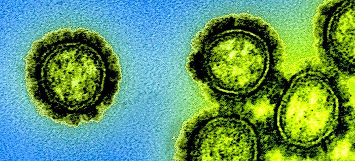 H1N1