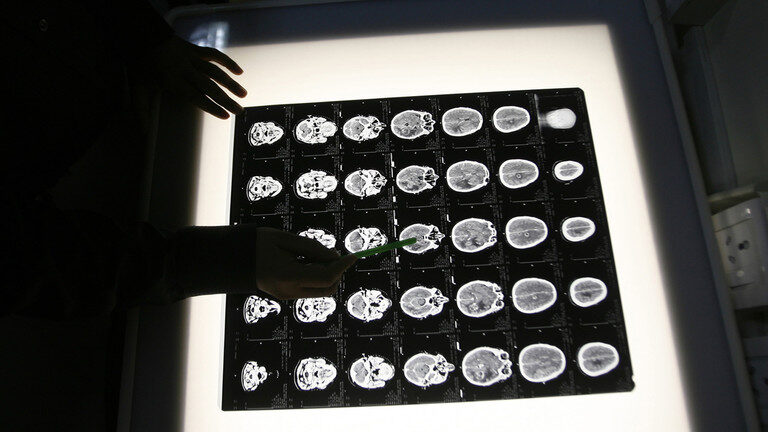 brain mri
