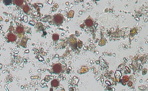 Microscope algae