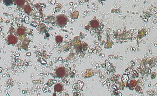 Microscope algae