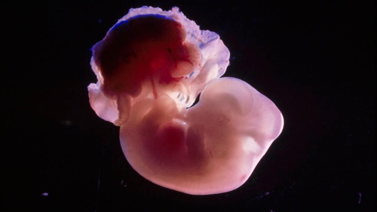 14 day old rat embryo.
