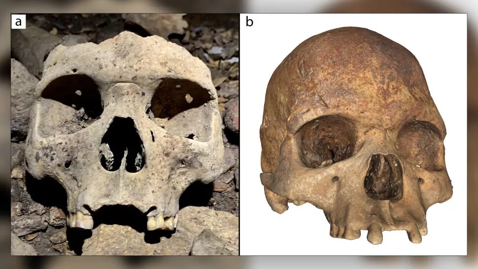 skull modification