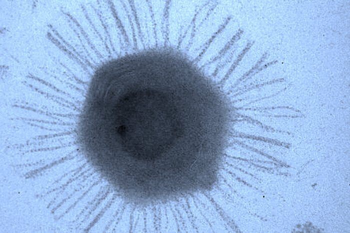 mimivirus