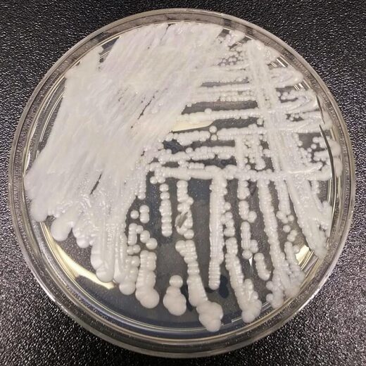 Candida auris