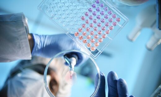 lab samples