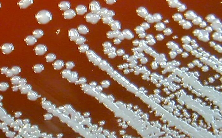 Click to enlarge culture bacteria