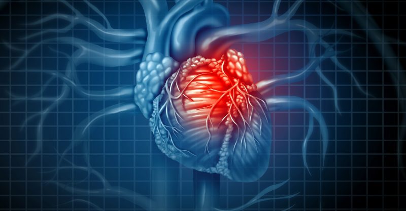 myocarditis covid