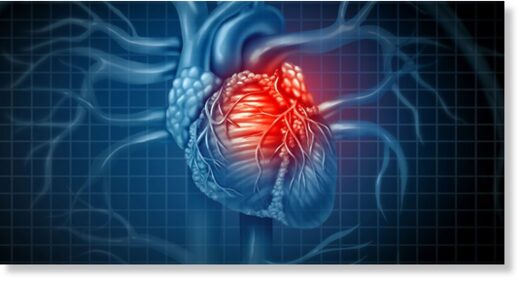 myocarditis covid