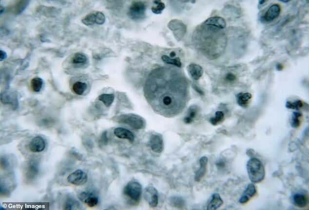 Click to enlarge Naegleria fowleri