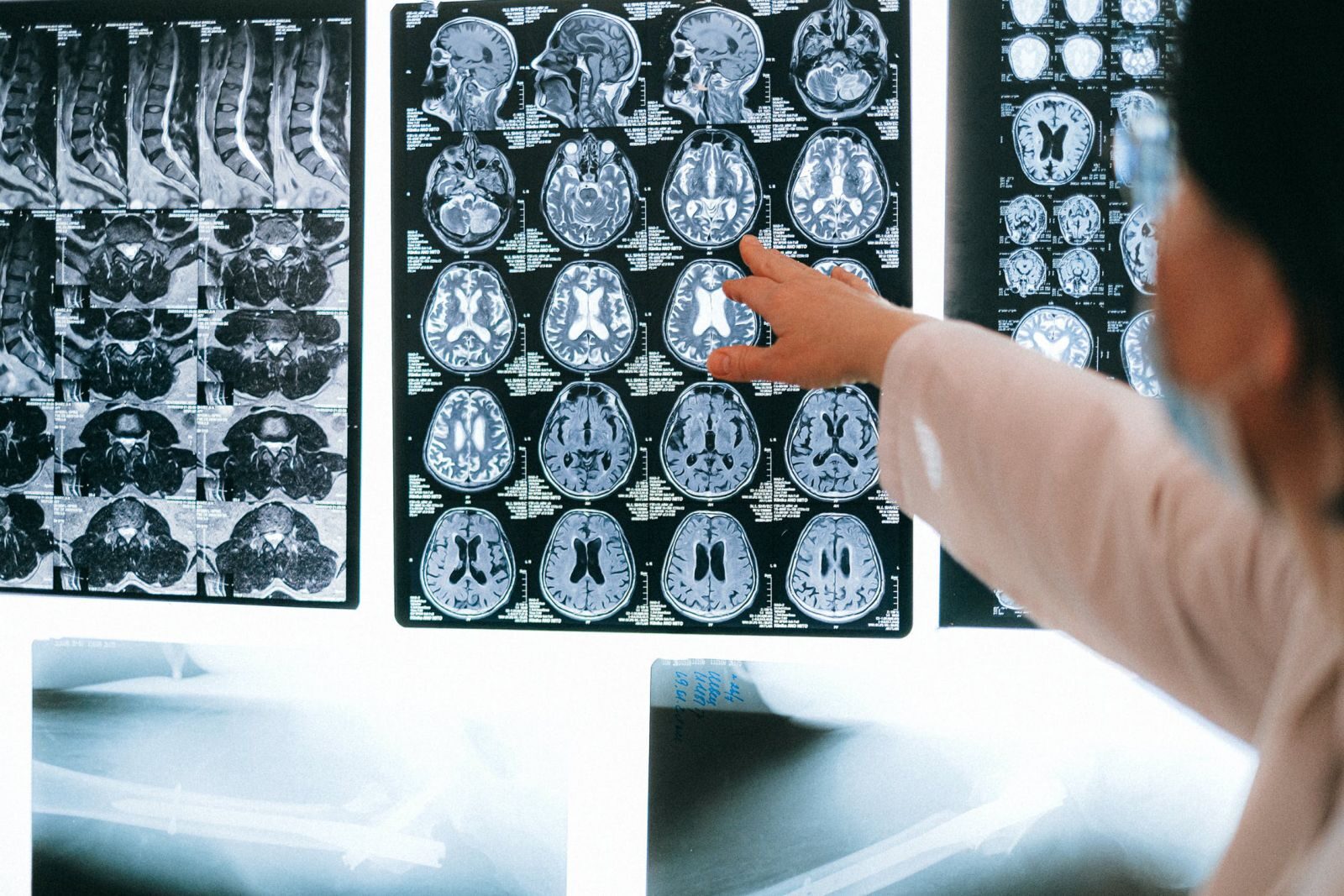 Click to enlarge MRI Scan