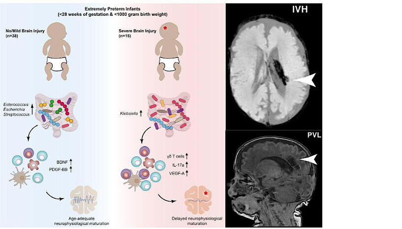 Brain Development