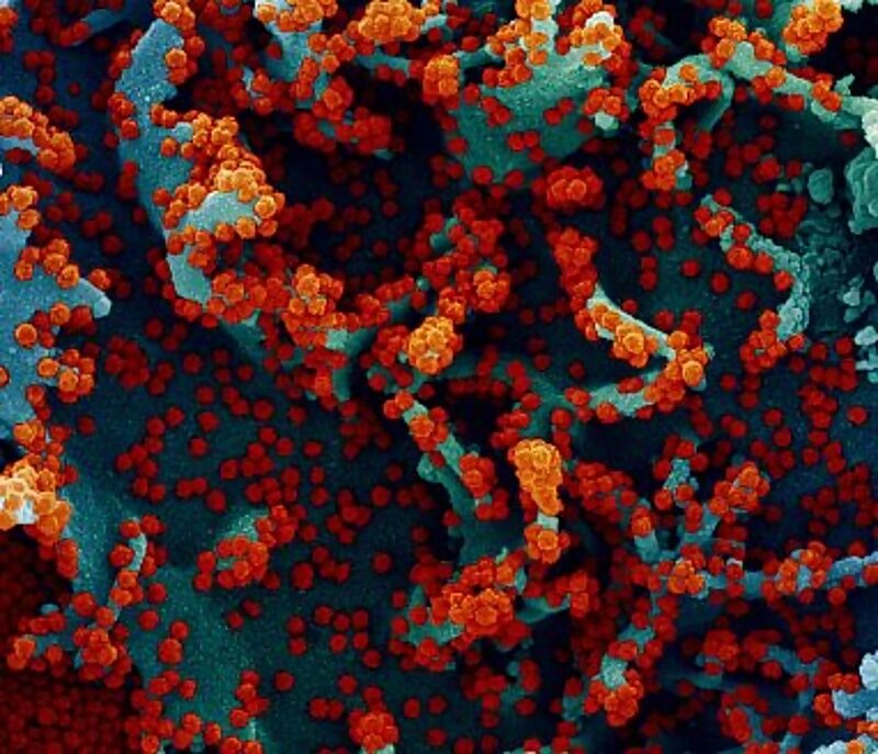 covid infection electron microscope scan