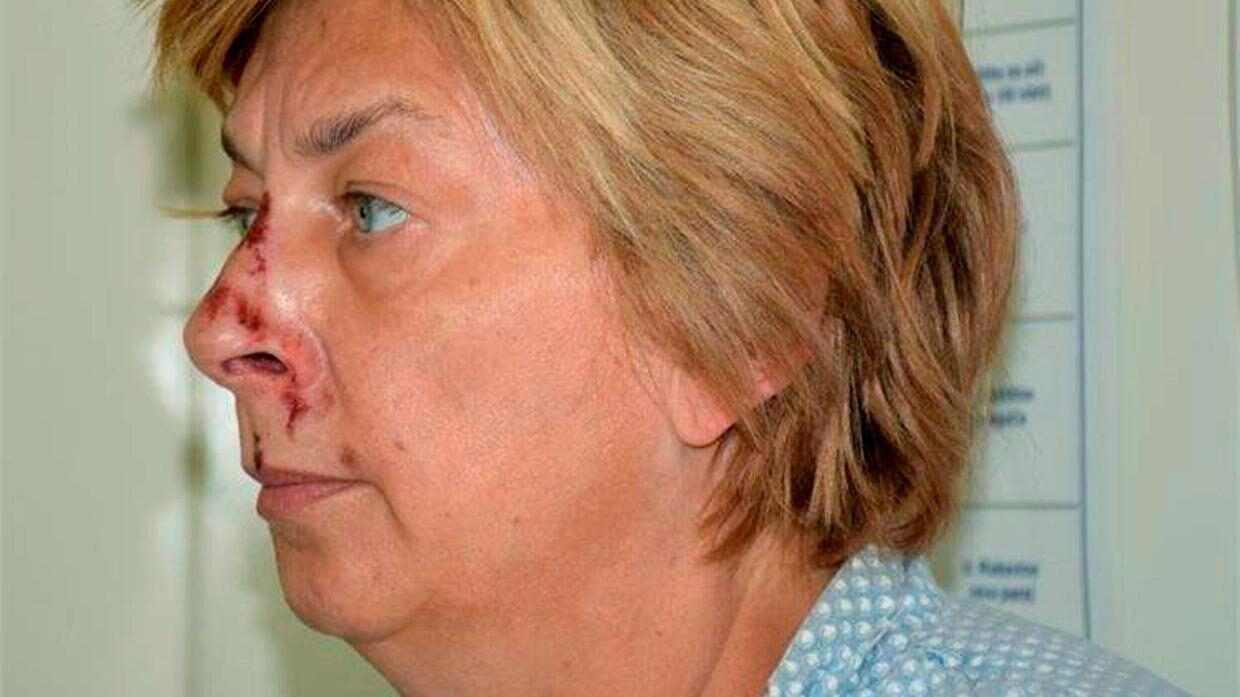 amnesia croatia woman island