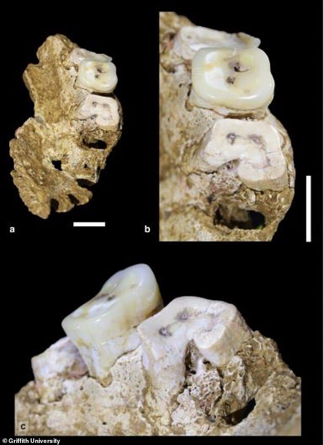 teeth