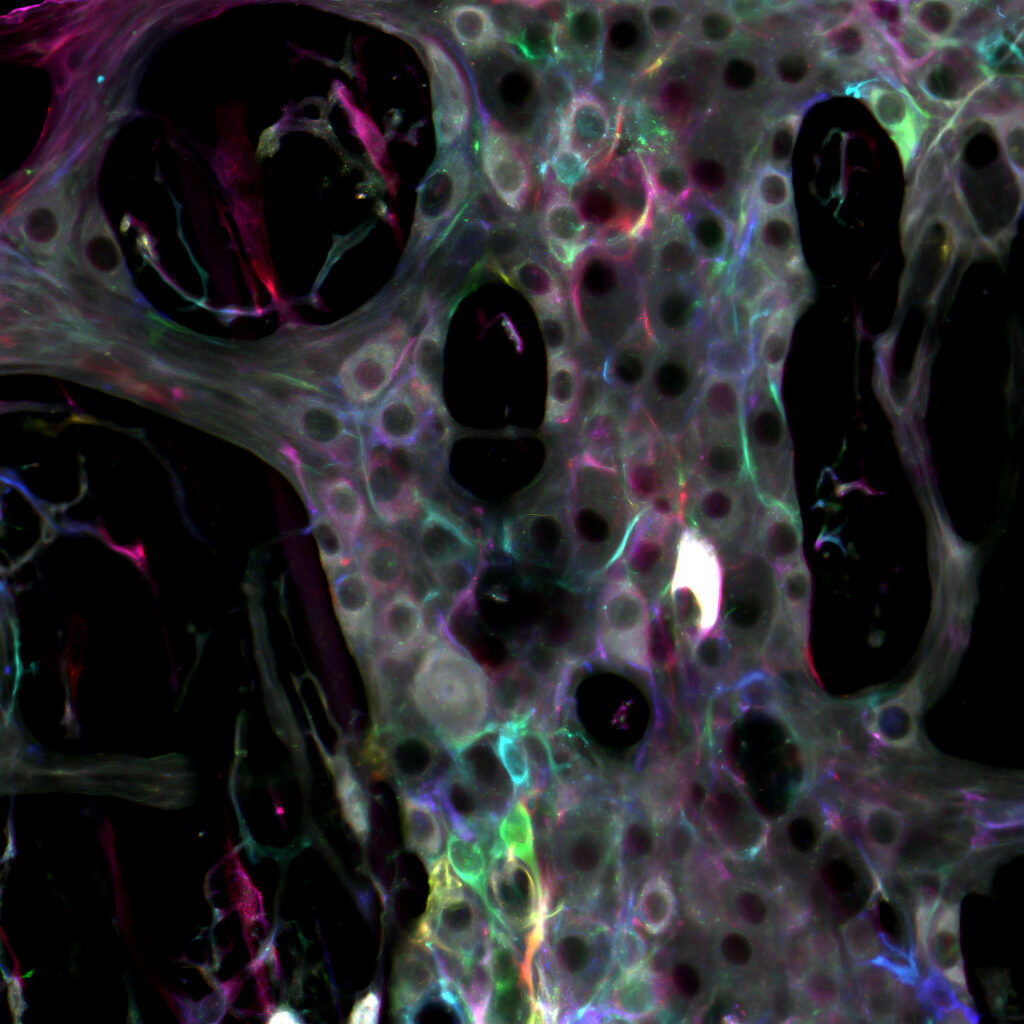 Glial Cells