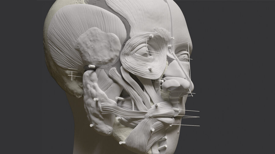 Click to enlarge Soft Tissue Filling