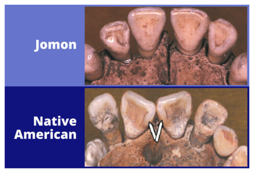 Jomon + Native American Teeth