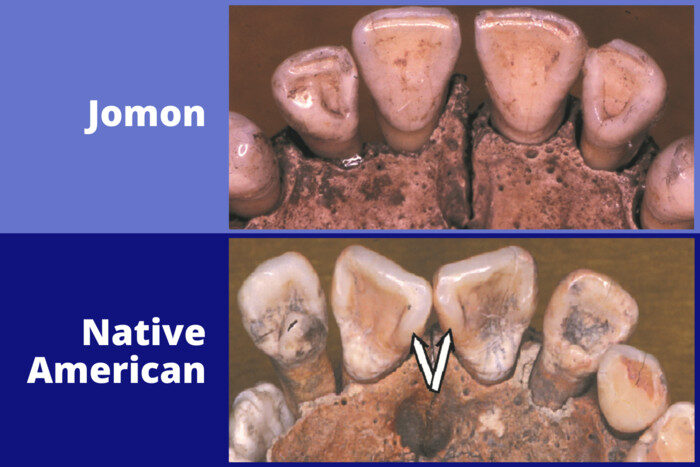 Click to enlarge Jomon + Native American Teeth