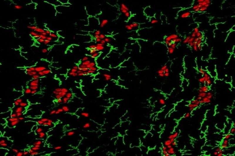 Macrophages
