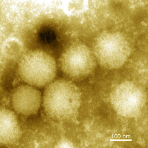 New tick-borne virus Yezo discovered in Japan