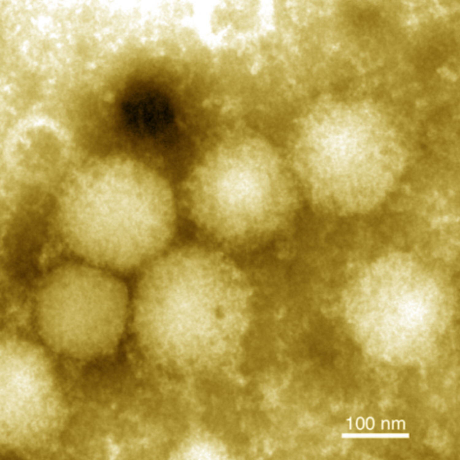 yezv virus