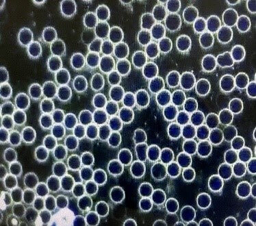 Click to enlarge Red Blood Cells