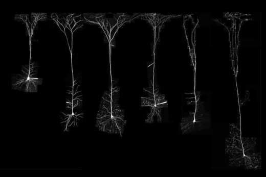 Click to enlarge pyramidal neurons