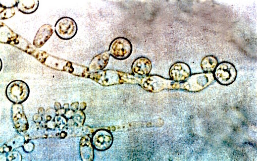 Candida albicans