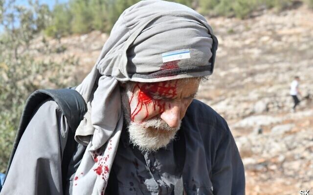 Click to enlarge israel settlers attack rabbie west ank