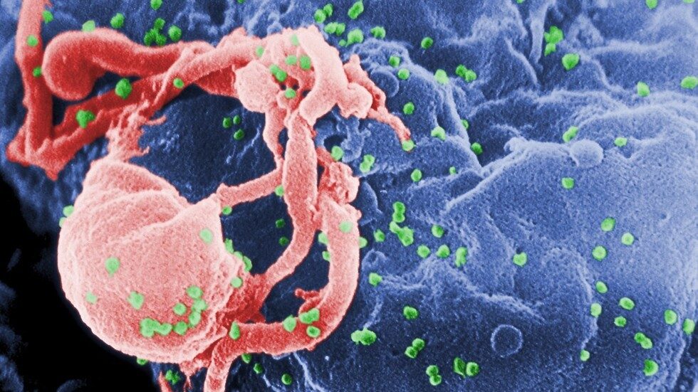 Micrograph of HIV-1 virus aids