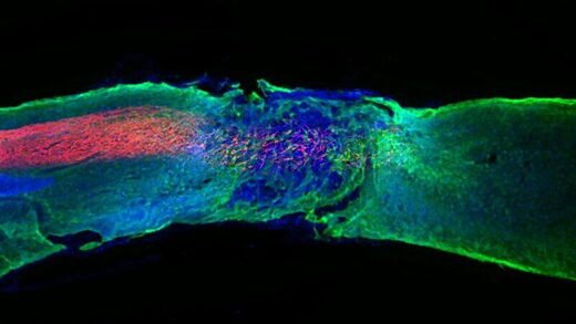 Click to enlarge nerve repair paralysis