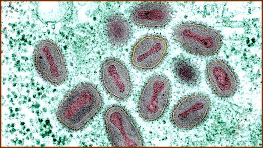 Click to enlarge Variola microscopy
