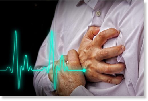 Heart Attack