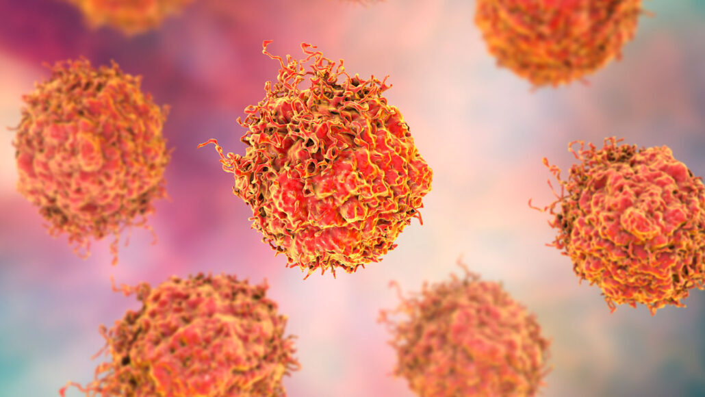 Click to enlarge prostate cells cancer studies replication problem